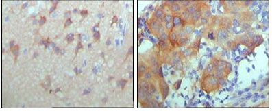 ErbB3 Antibody in Immunohistochemistry (Paraffin) (IHC (P))