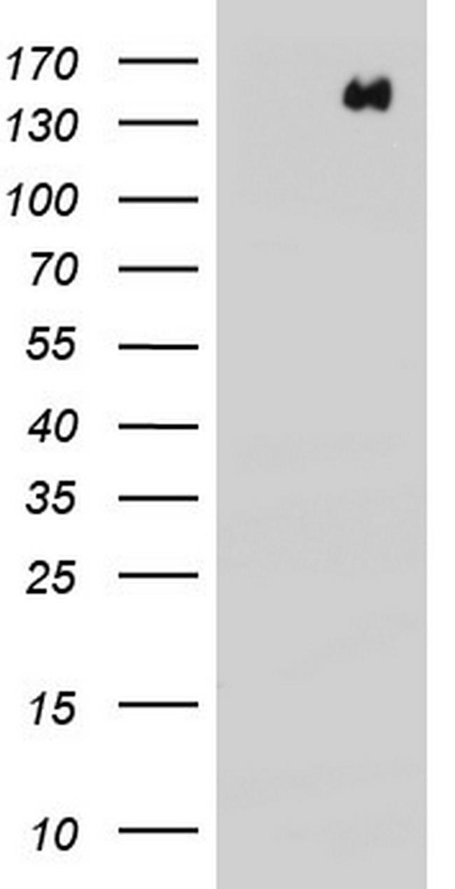 ERBB4 Antibody in Western Blot (WB)