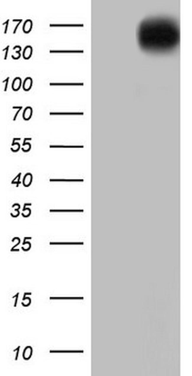 ERBB4 Antibody in Western Blot (WB)