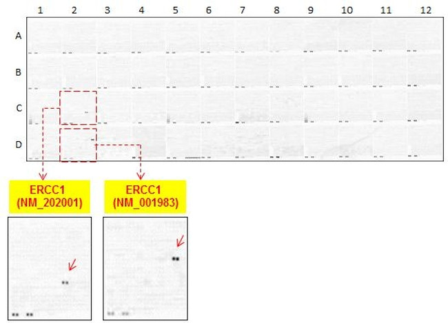 ERCC1 Antibody in Peptide array (ARRAY)