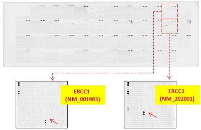 ERCC1 Antibody in Peptide array (ARRAY)