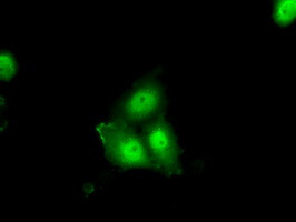 ERCC1 Antibody in Immunocytochemistry (ICC/IF)