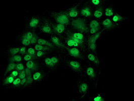 ERCC1 Antibody in Immunocytochemistry (ICC/IF)