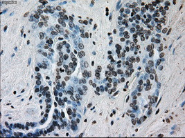 ERCC1 Antibody in Immunohistochemistry (Paraffin) (IHC (P))