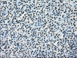 ERCC1 Antibody in Immunohistochemistry (Paraffin) (IHC (P))