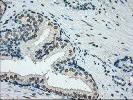 ERCC1 Antibody in Immunohistochemistry (Paraffin) (IHC (P))