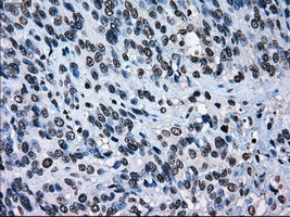 ERCC1 Antibody in Immunohistochemistry (Paraffin) (IHC (P))