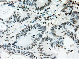 ERCC1 Antibody in Immunohistochemistry (Paraffin) (IHC (P))