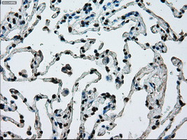 ERCC1 Antibody in Immunohistochemistry (Paraffin) (IHC (P))