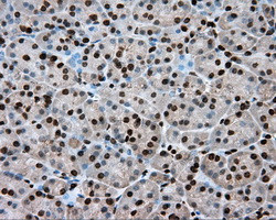 ERCC1 Antibody in Immunohistochemistry (Paraffin) (IHC (P))