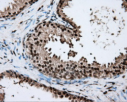 ERCC1 Antibody in Immunohistochemistry (Paraffin) (IHC (P))