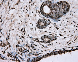 ERCC1 Antibody in Immunohistochemistry (Paraffin) (IHC (P))