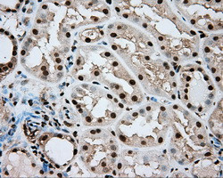 ERCC1 Antibody in Immunohistochemistry (Paraffin) (IHC (P))