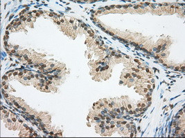 ERCC1 Antibody in Immunohistochemistry (Paraffin) (IHC (P))