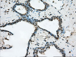 ERCC1 Antibody in Immunohistochemistry (Paraffin) (IHC (P))