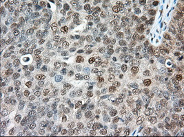 ERCC1 Antibody in Immunohistochemistry (Paraffin) (IHC (P))