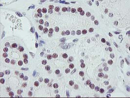 ERCC1 Antibody in Immunohistochemistry (Paraffin) (IHC (P))