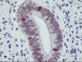 ERCC1 Antibody in Immunohistochemistry (Paraffin) (IHC (P))