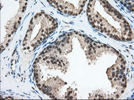 ERCC1 Antibody in Immunohistochemistry (Paraffin) (IHC (P))