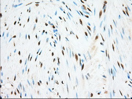 ERCC1 Antibody in Immunohistochemistry (Paraffin) (IHC (P))