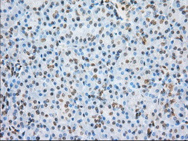 ERCC1 Antibody in Immunohistochemistry (Paraffin) (IHC (P))