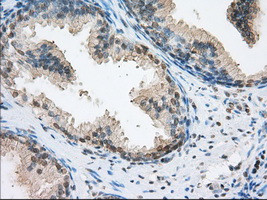 ERCC1 Antibody in Immunohistochemistry (Paraffin) (IHC (P))