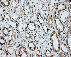 ERCC1 Antibody in Immunohistochemistry (Paraffin) (IHC (P))