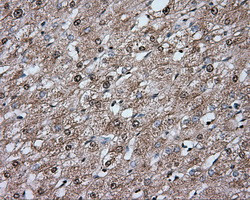 ERCC1 Antibody in Immunohistochemistry (Paraffin) (IHC (P))