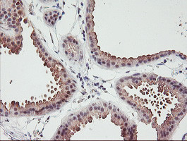 ERCC1 Antibody in Immunohistochemistry (Paraffin) (IHC (P))