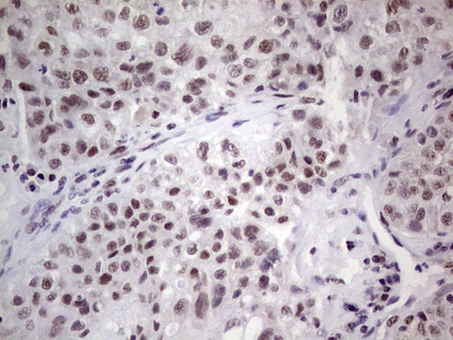 ERCC1 Antibody in Immunohistochemistry (Paraffin) (IHC (P))