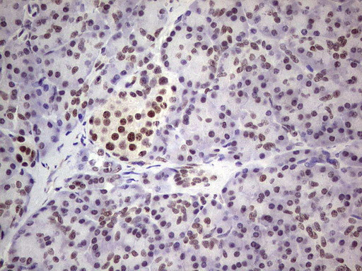 ERCC1 Antibody in Immunohistochemistry (Paraffin) (IHC (P))