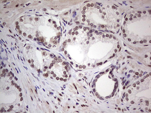 ERCC1 Antibody in Immunohistochemistry (Paraffin) (IHC (P))