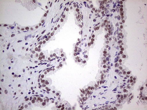 ERCC1 Antibody in Immunohistochemistry (Paraffin) (IHC (P))