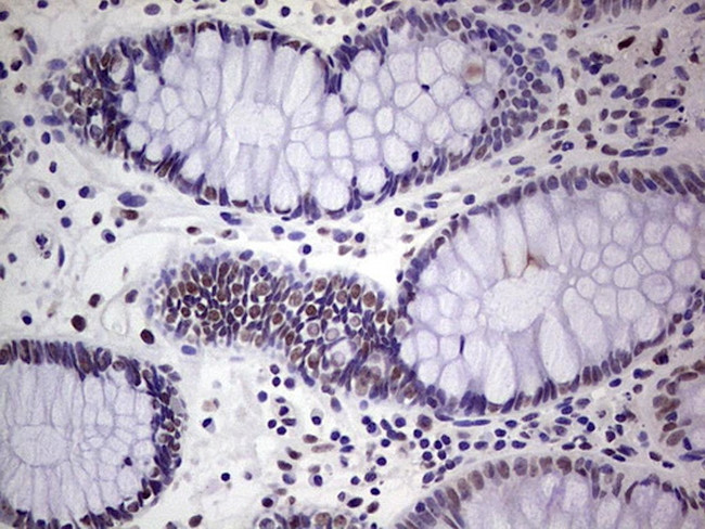 ERCC1 Antibody in Immunohistochemistry (Paraffin) (IHC (P))