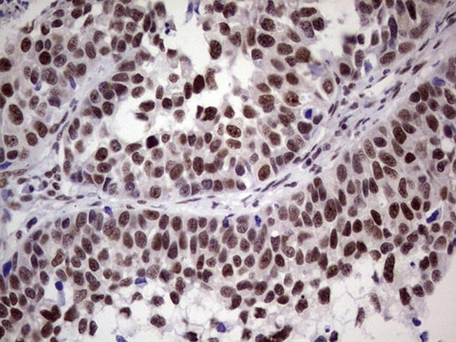 ERCC1 Antibody in Immunohistochemistry (Paraffin) (IHC (P))