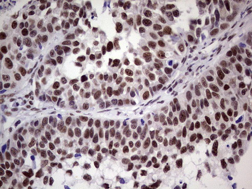 ERCC1 Antibody in Immunohistochemistry (Paraffin) (IHC (P))