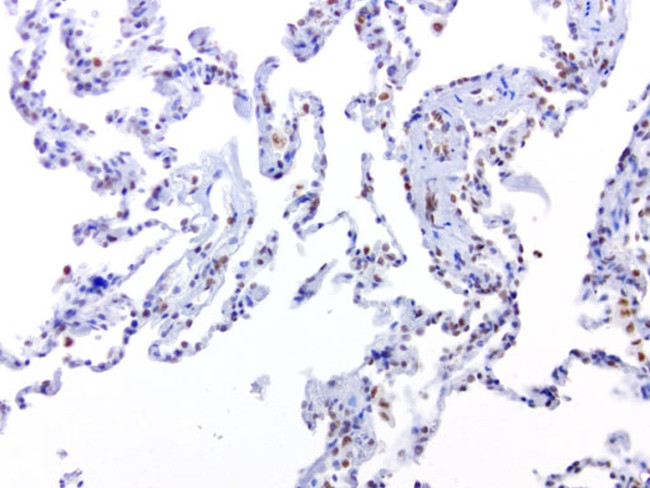 ERCC1 Antibody in Immunohistochemistry (Paraffin) (IHC (P))