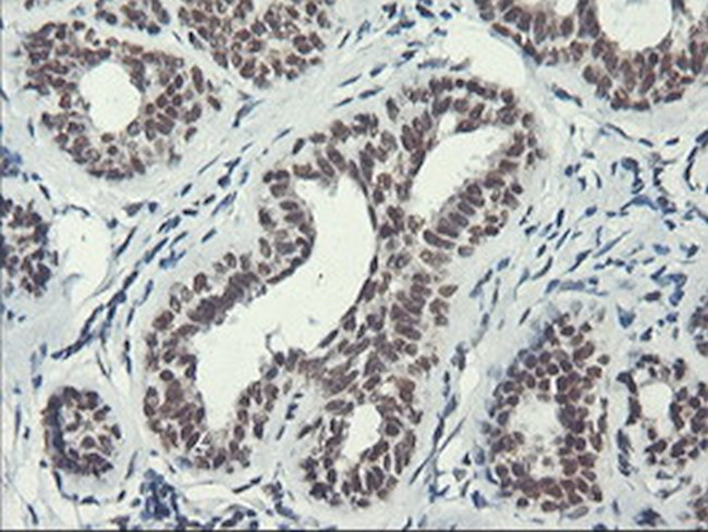 ERCC1 Antibody in Immunohistochemistry (Paraffin) (IHC (P))