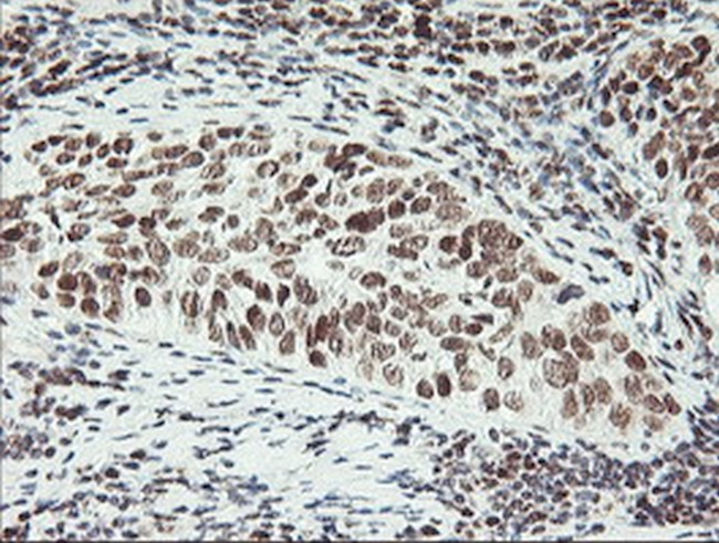 ERCC1 Antibody in Immunohistochemistry (Paraffin) (IHC (P))