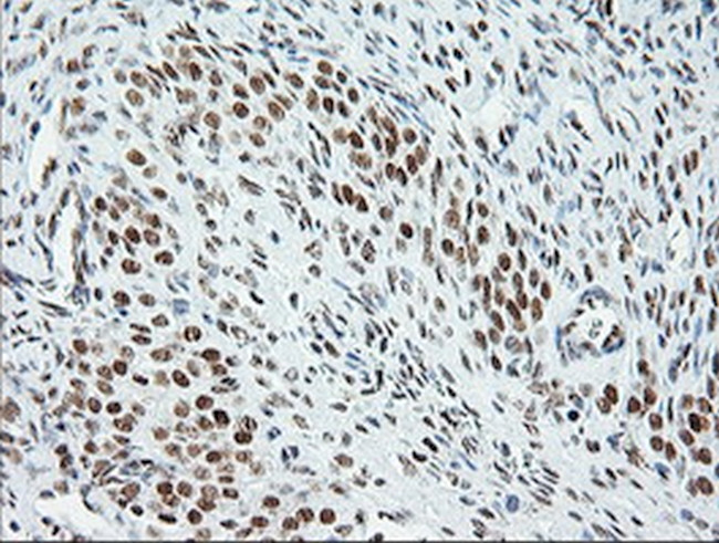 ERCC1 Antibody in Immunohistochemistry (Paraffin) (IHC (P))