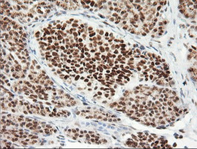 ERCC1 Antibody in Immunohistochemistry (Paraffin) (IHC (P))