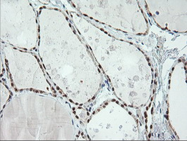 ERCC1 Antibody in Immunohistochemistry (Paraffin) (IHC (P))