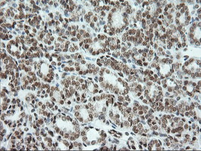 ERCC1 Antibody in Immunohistochemistry (Paraffin) (IHC (P))