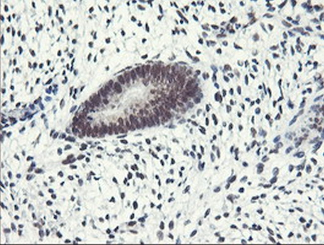 ERCC1 Antibody in Immunohistochemistry (Paraffin) (IHC (P))