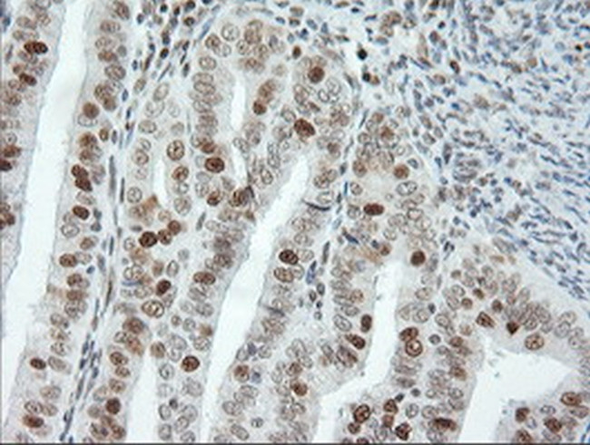 ERCC1 Antibody in Immunohistochemistry (Paraffin) (IHC (P))