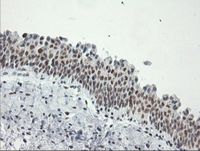 ERCC1 Antibody in Immunohistochemistry (Paraffin) (IHC (P))