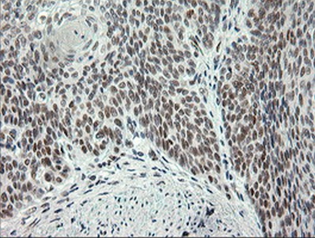 ERCC1 Antibody in Immunohistochemistry (Paraffin) (IHC (P))