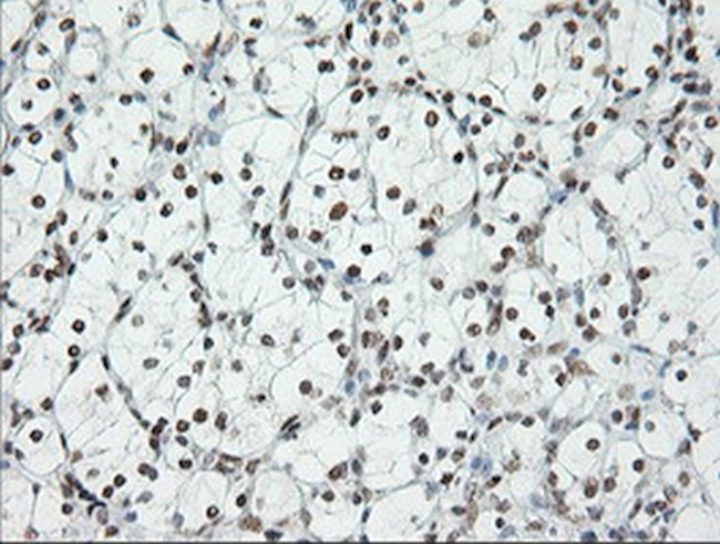 ERCC1 Antibody in Immunohistochemistry (Paraffin) (IHC (P))