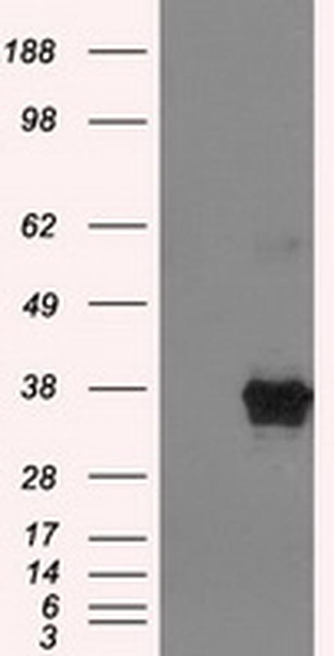 ERCC1 Antibody in Western Blot (WB)