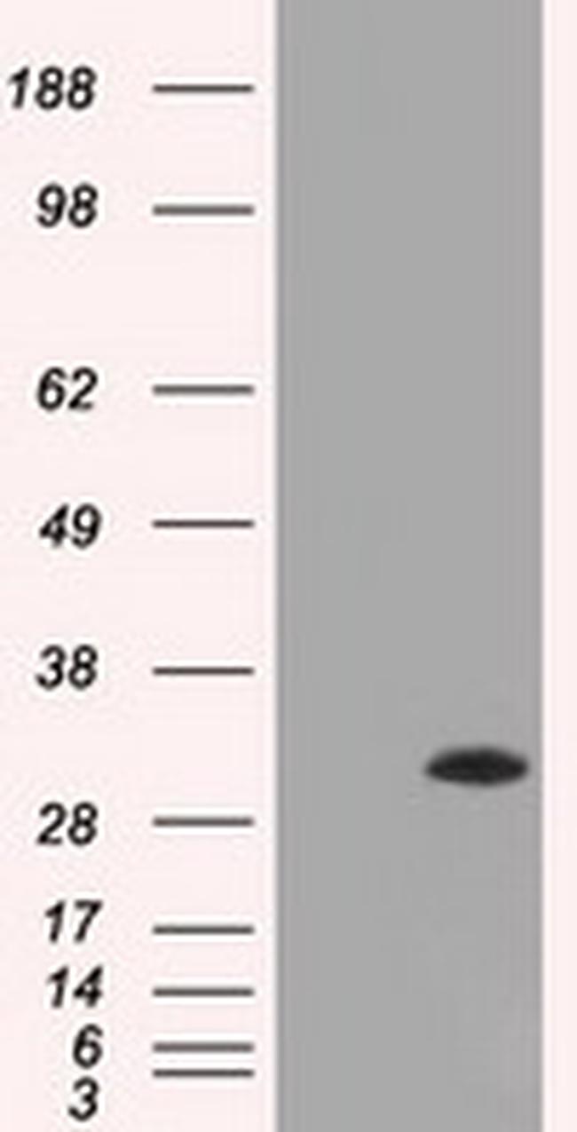 ERCC1 Antibody in Western Blot (WB)